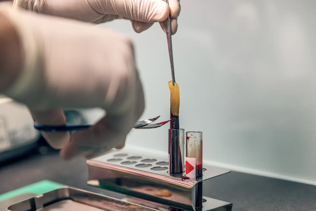 Dental technician mixing resin | 24th Street Dental in Phoenix, AZ