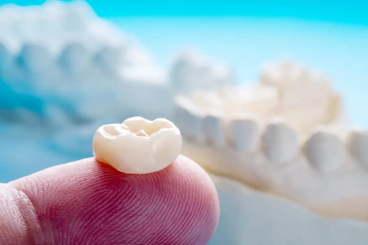 Crowns by 24th Street Dental Biltmore in Arizona