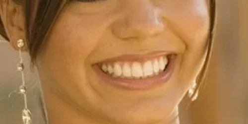 Close-up of teeth after Invisalign treatment at 24th Street Dental in Phoenix, AZ