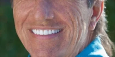 Close-up of teeth after treatment in Phoenix, AZ | 24th Street Dental Biltmore