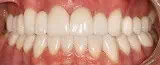 Aligned teeth in Phoenix, AZ | 24th Street Dental Biltmore