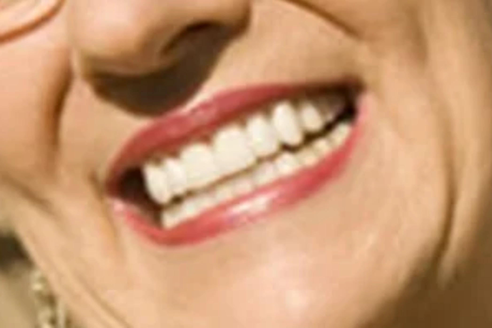 Close-up of woman's smile after getting Porcelain Veneers Treatment | 24th Street Dental Biltmore in Phoenix, AZ