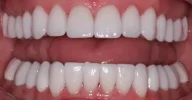 Whitened teeth after cosmetic dental treatment in Phoenix, AZ | 24th Street Dental Biltmore